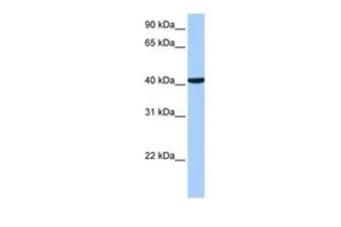 Anti-CC2D1B antibody, C-term used in Western Blot (WB). GTX45782