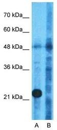 Anti-WARS2 antibody, Internal used in Western Blot (WB). GTX45787