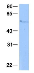 Anti-METAP2 antibody, N-term used in Western Blot (WB). GTX45796