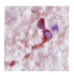 Anti-CPLX2 antibody, N-term used in IHC (Paraffin sections) (IHC-P). GTX45797