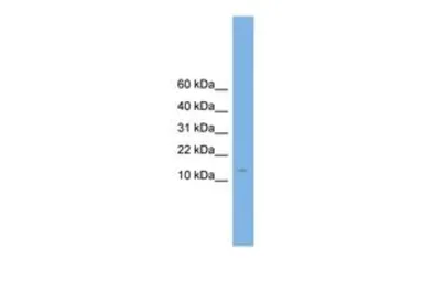 Anti-CPLX2 antibody, N-term used in Western Blot (WB). GTX45797