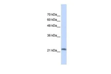 Anti-RASL10A antibody, N-term used in Western Blot (WB). GTX45802