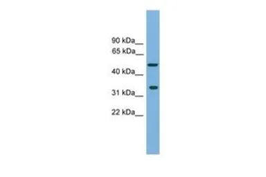 Anti-CFDP1 antibody, Internal used in Western Blot (WB). GTX45805