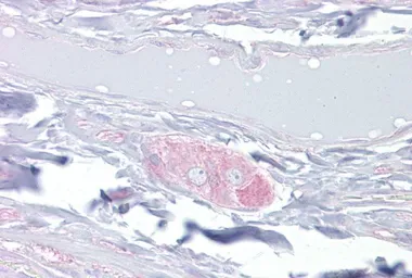 Anti-CRMP4 antibody, Internal used in IHC (Paraffin sections) (IHC-P). GTX45814