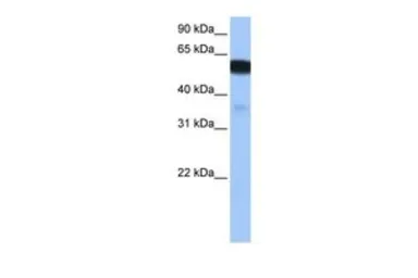 Anti-NHEDC1 antibody, N-term used in Western Blot (WB). GTX45820