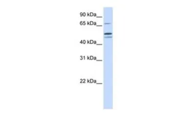 Anti-EARS2 antibody, Internal used in Western Blot (WB). GTX45829