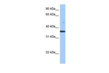 Anti-FAM153B antibody, Internal used in Western Blot (WB). GTX45830