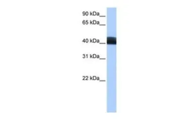 Anti-LRRC17 antibody, Internal used in Western Blot (WB). GTX45836