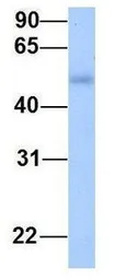 Anti-LRRC17 antibody, Internal used in Western Blot (WB). GTX45836