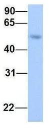 Anti-LRRC17 antibody, Internal used in Western Blot (WB). GTX45836