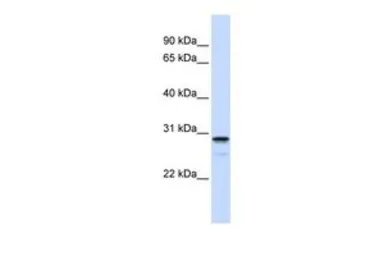 Anti-FAM78B antibody, Internal used in Western Blot (WB). GTX45837