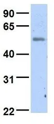 Anti-C18orf25 antibody, Internal used in Western Blot (WB). GTX45842