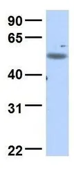 Anti-C18orf25 antibody, Internal used in Western Blot (WB). GTX45842
