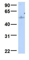 Anti-C18orf25 antibody, Internal used in Western Blot (WB). GTX45842