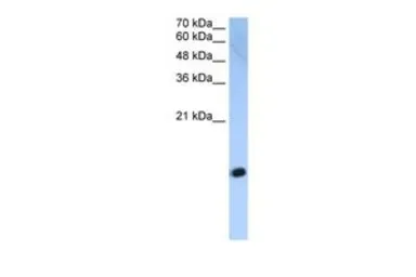Anti-HIST2H2AC antibody, Internal used in Western Blot (WB). GTX45852