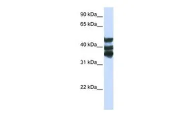 Anti-HGD antibody, Internal used in Western Blot (WB). GTX45853