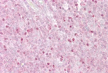 Anti-OAS1 antibody, C-term used in IHC (Paraffin sections) (IHC-P). GTX45855