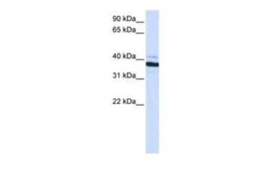 Anti-OAS1 antibody, C-term used in Western Blot (WB). GTX45855