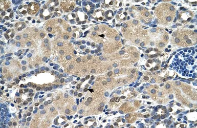 Anti-ASPH antibody, N-term used in IHC (Paraffin sections) (IHC-P). GTX45856