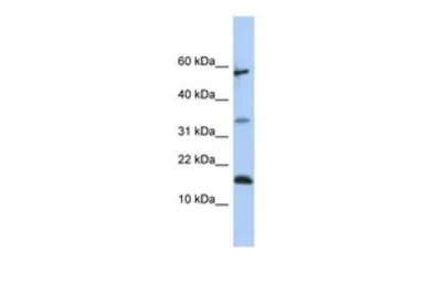 Anti-LCN6 antibody, Internal used in Western Blot (WB). GTX45870