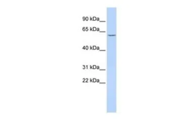 Anti-CES7 antibody, Internal used in Western Blot (WB). GTX45871