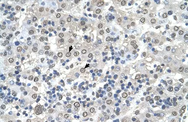Anti-CDR2 antibody, N-term used in IHC (Paraffin sections) (IHC-P). GTX45873