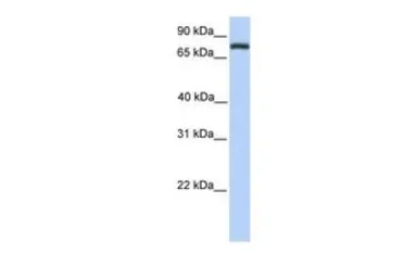 Anti-COLEC12 antibody, Internal used in Western Blot (WB). GTX45877