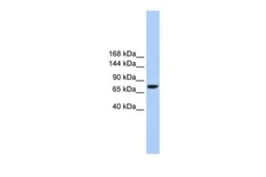 Anti-TMC2 antibody, Internal used in Western Blot (WB). GTX45881