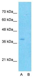 Anti-CYTB antibody, N-term used in Western Blot (WB). GTX45884