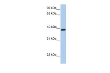 Anti-Aquaporin 10 antibody, C-term used in Western Blot (WB). GTX45889