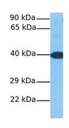 Anti-MOGAT1 antibody, C-term used in Western Blot (WB). GTX45890