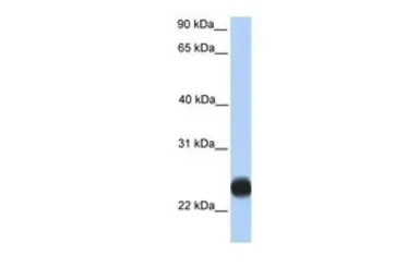 Anti-Porimin antibody, C-term used in Western Blot (WB). GTX45892