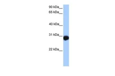 Anti-SLAMF6 antibody, N-term used in Western Blot (WB). GTX45894