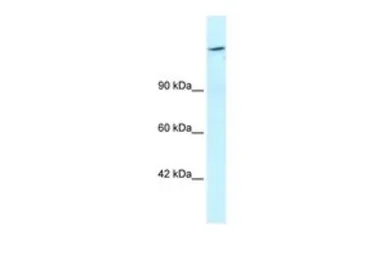 Anti-ARID4A antibody, C-term used in Western Blot (WB). GTX45913