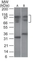 Anti-NFAT2 antibody used in Western Blot (WB). GTX45916