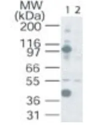 Anti-NFAT2 antibody used in Western Blot (WB). GTX45916