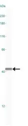 Anti-NFAT2 antibody used in Western Blot (WB). GTX45916
