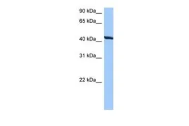 Anti-TMEM118 antibody, N-term used in Western Blot (WB). GTX45921