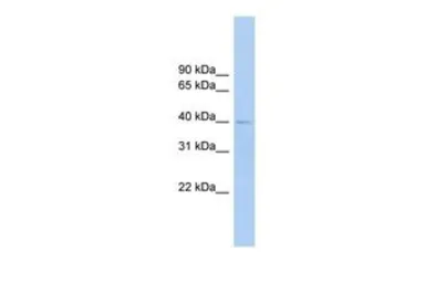 Anti-FCRLM1 antibody, Internal used in Western Blot (WB). GTX45923