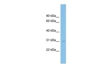 Anti-SPATA9 antibody, N-term used in Western Blot (WB). GTX45934