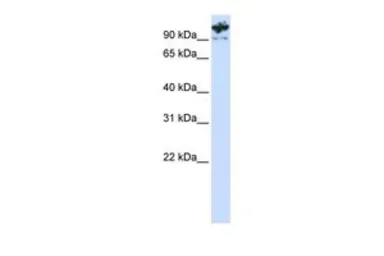 Anti-PCDHA6 antibody, C-term used in Western Blot (WB). GTX45941