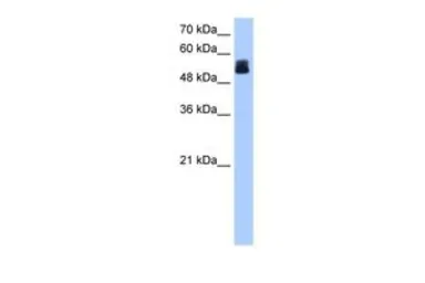 Anti-CRISPLD2 antibody, N-term used in Western Blot (WB). GTX45942