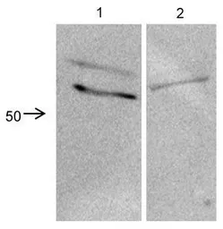 Anti-CRISPLD2 antibody, N-term used in Western Blot (WB). GTX45942