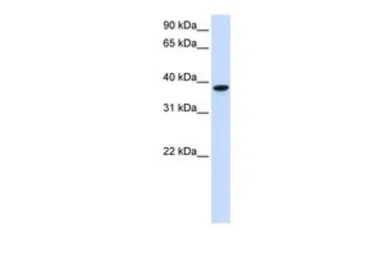 Anti-GLT8D2 antibody, C-term used in Western Blot (WB). GTX45945