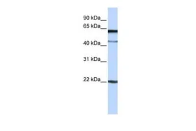 Anti-C6ORF25 antibody, N-term used in Western Blot (WB). GTX45953