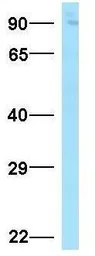 Anti-SUN1 antibody, N-term used in Western Blot (WB). GTX45959