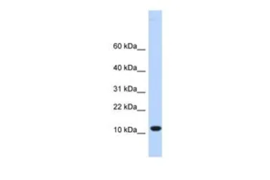 Anti-C10ORF57 antibody, Internal used in Western Blot (WB). GTX45960