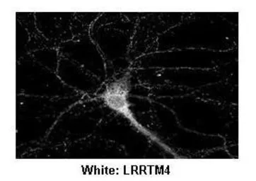 Anti-LRRTM4 antibody, Internal used in Immunocytochemistry/ Immunofluorescence (ICC/IF). GTX45963