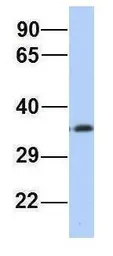 Anti-PAQR6 antibody, N-term used in Western Blot (WB). GTX45966