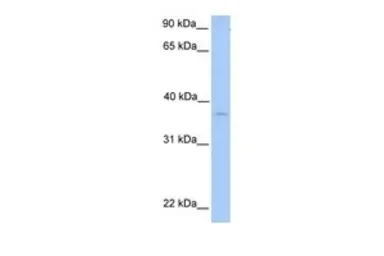 Anti-NPAL2 antibody, N-term used in Western Blot (WB). GTX45972